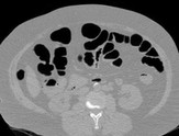 Vue 2D, fenêtre pulmonaire